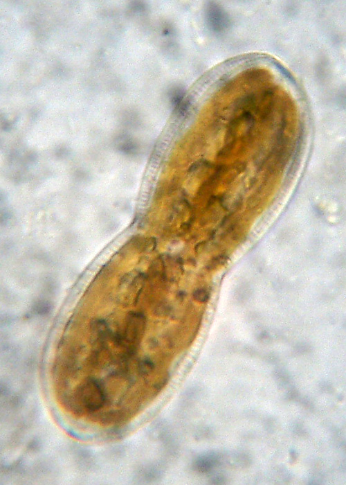 Diatomee marine